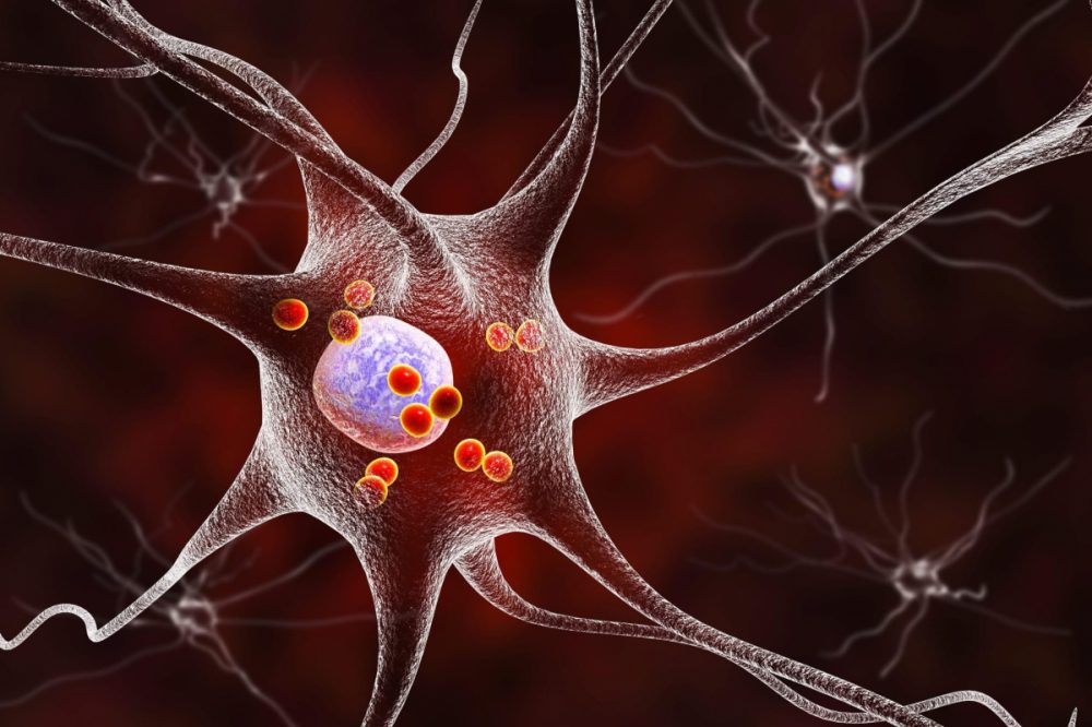 Edinburgh Innovations | Cell model of Parkinson’s disease