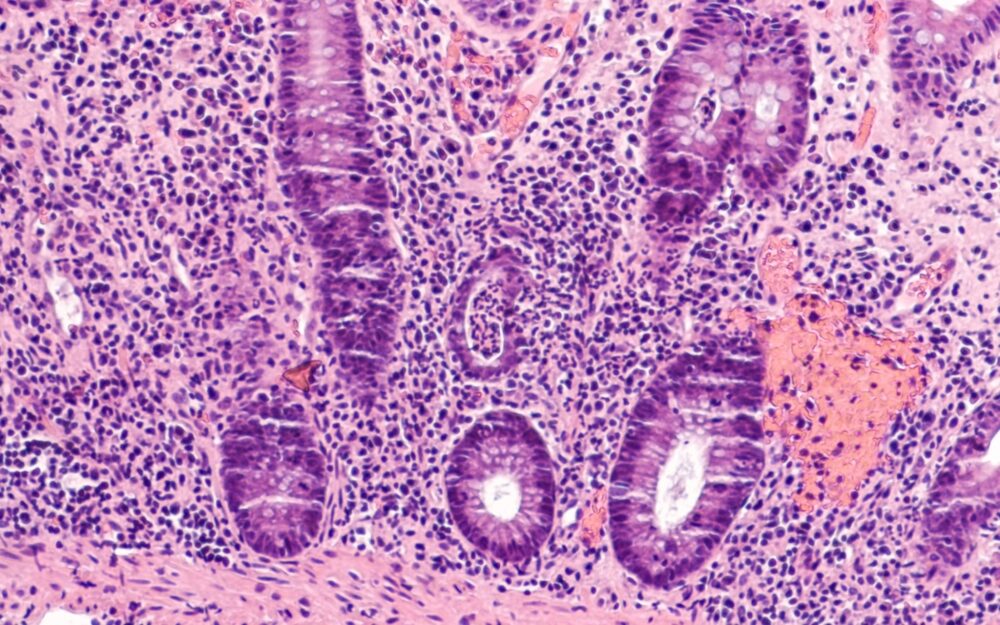 Adobe Stock 289127808 David A Litman