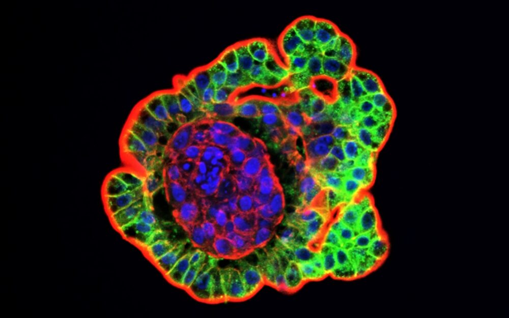 Chicken Cell Body Image