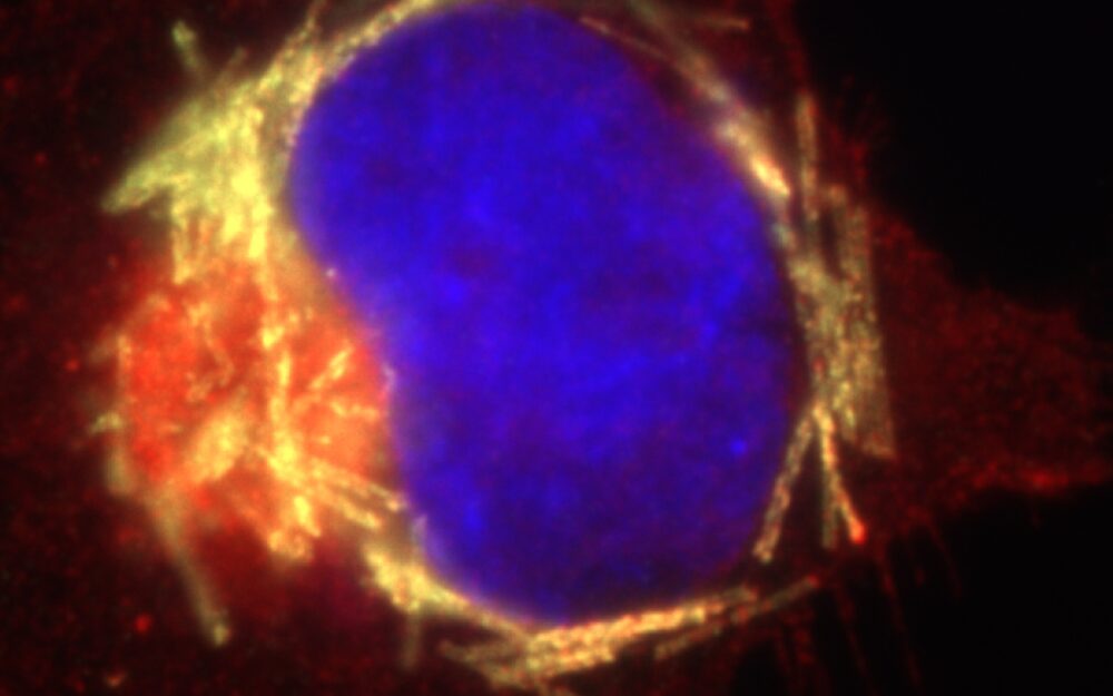 Nick Gilbert Bench to Bedside Blog