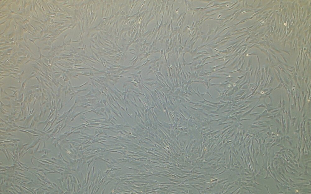 Simon Brown Bench to Bedside Blog 33