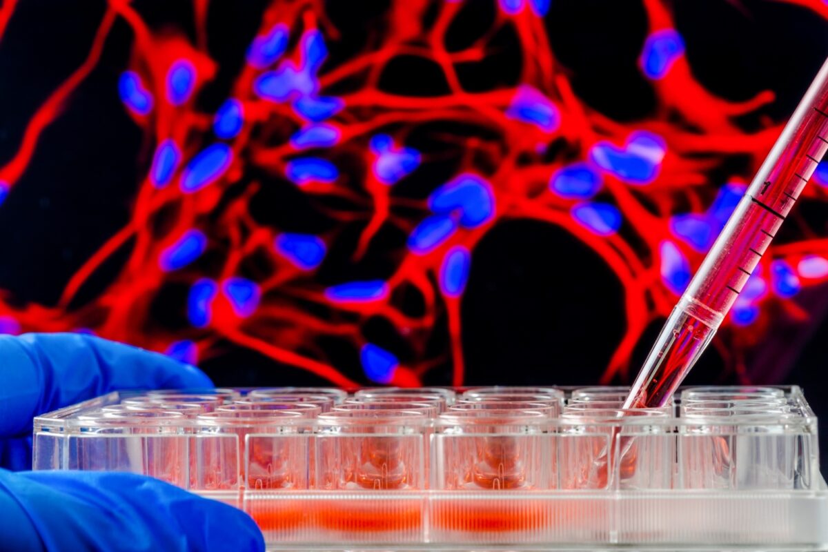 Adobe Stock 120432643hakat