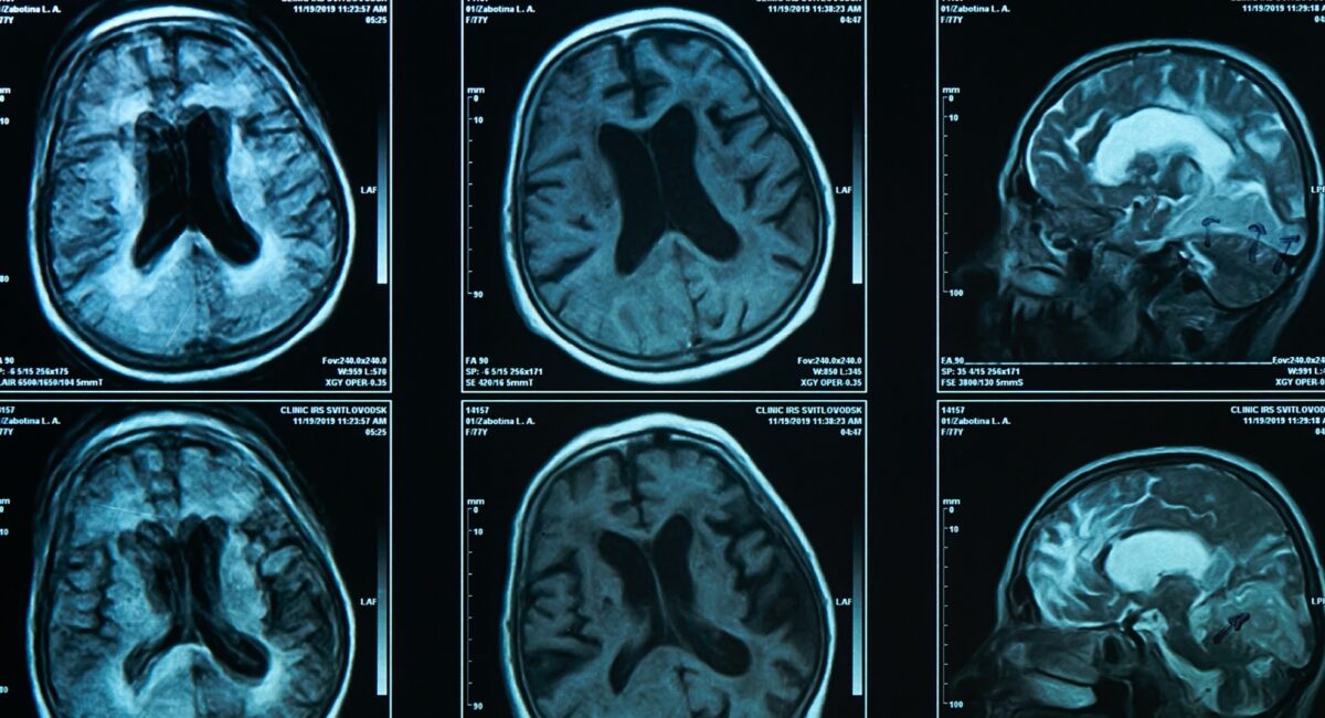 Adobe Stock 503789932 Александр Марченко Header