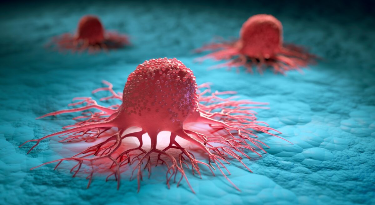 Nuvectispeterschreiber media