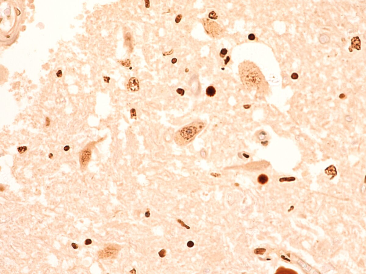 TEC 4423 NCD APT SC 0039 RGB Trans