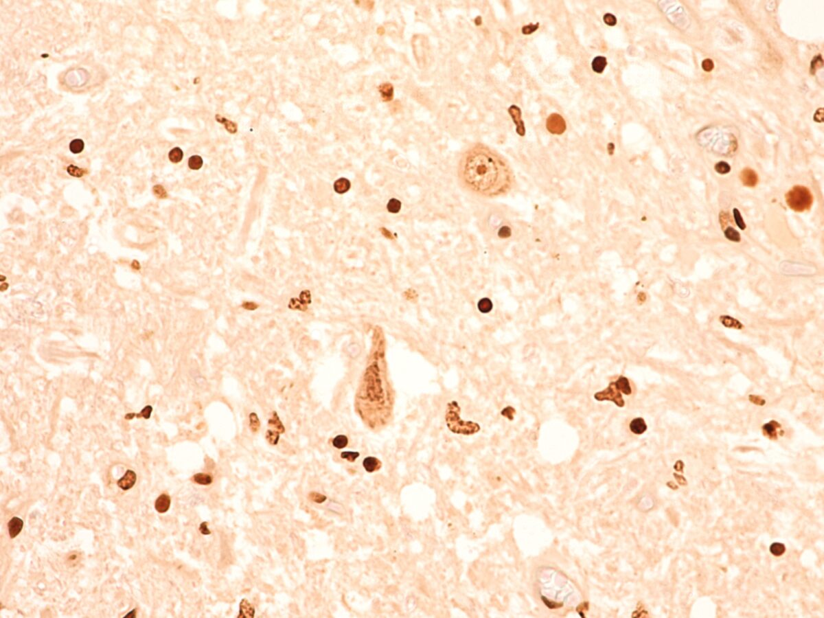 TEC 4423 NCD APT SC 0040 RGB Trans