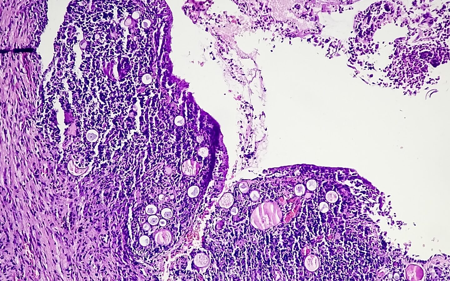 Adobe Stock 476349137 Arif Biswas Body Image