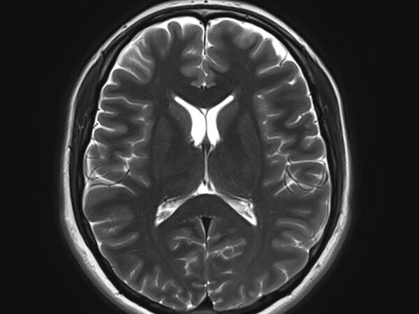 3 CREDIT University of Edinburgh SINGLE USE ONLY