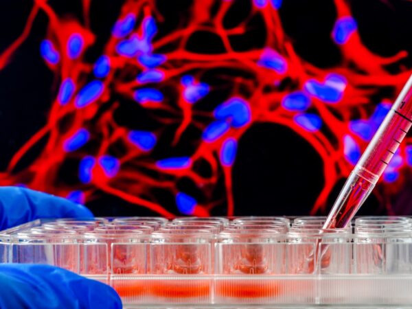 Adobe Stock 120432643hakat