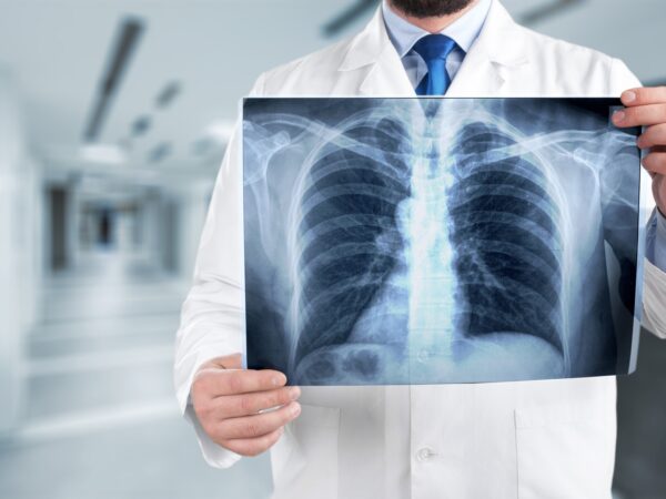 Adobe Stock 138376049 Billion Photos web