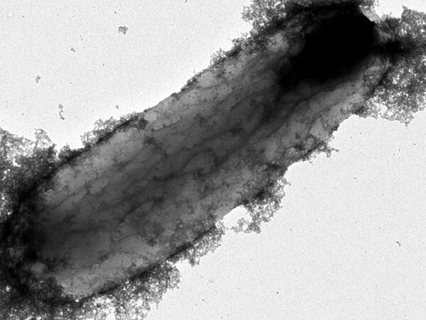 Header image: Desulfovibrio alaskensis cell associated with nanomicellar surfactant. Source: Dr Yuta Era with permission