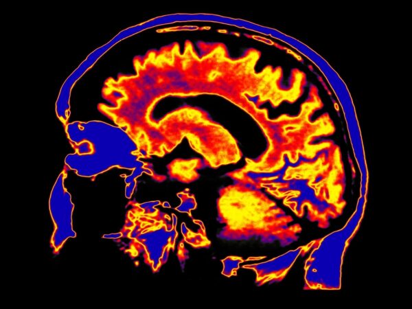 Getty Images 986666126 Daisy Daisy