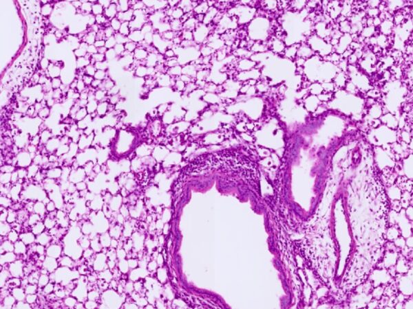 Inflamed lung Header Image
