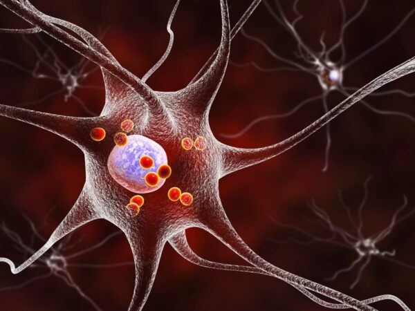 Neurons in Parkinsons disease image Dr Microbe