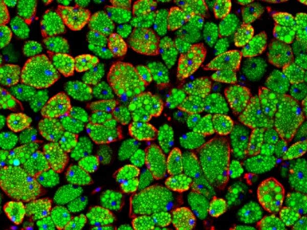 TEC4562 NCD Fa T Ty Web Header