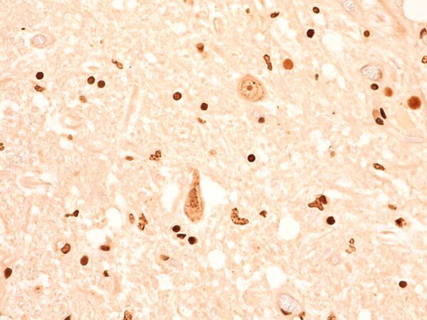 TEC 4423 NCD APT SC 0040 RGB Trans